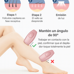 Depiladora Láser Ipl